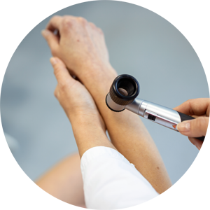 Nahaufnahme einer medizinischen Untersuchung durch einen Hautarzt, bei der ein Hautareal mit einem Dermatoskop dermatologisch untersucht wird - Fokus auf Dermatologie, Hautkrebsvorsorge und ästhetische Hautbehandlungen in einer Hautarztpraxis für Dermatologie & Ästhetik in Leipzig.
